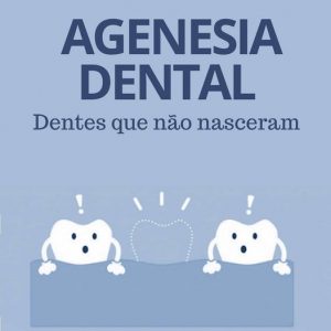 Agenesia Dental